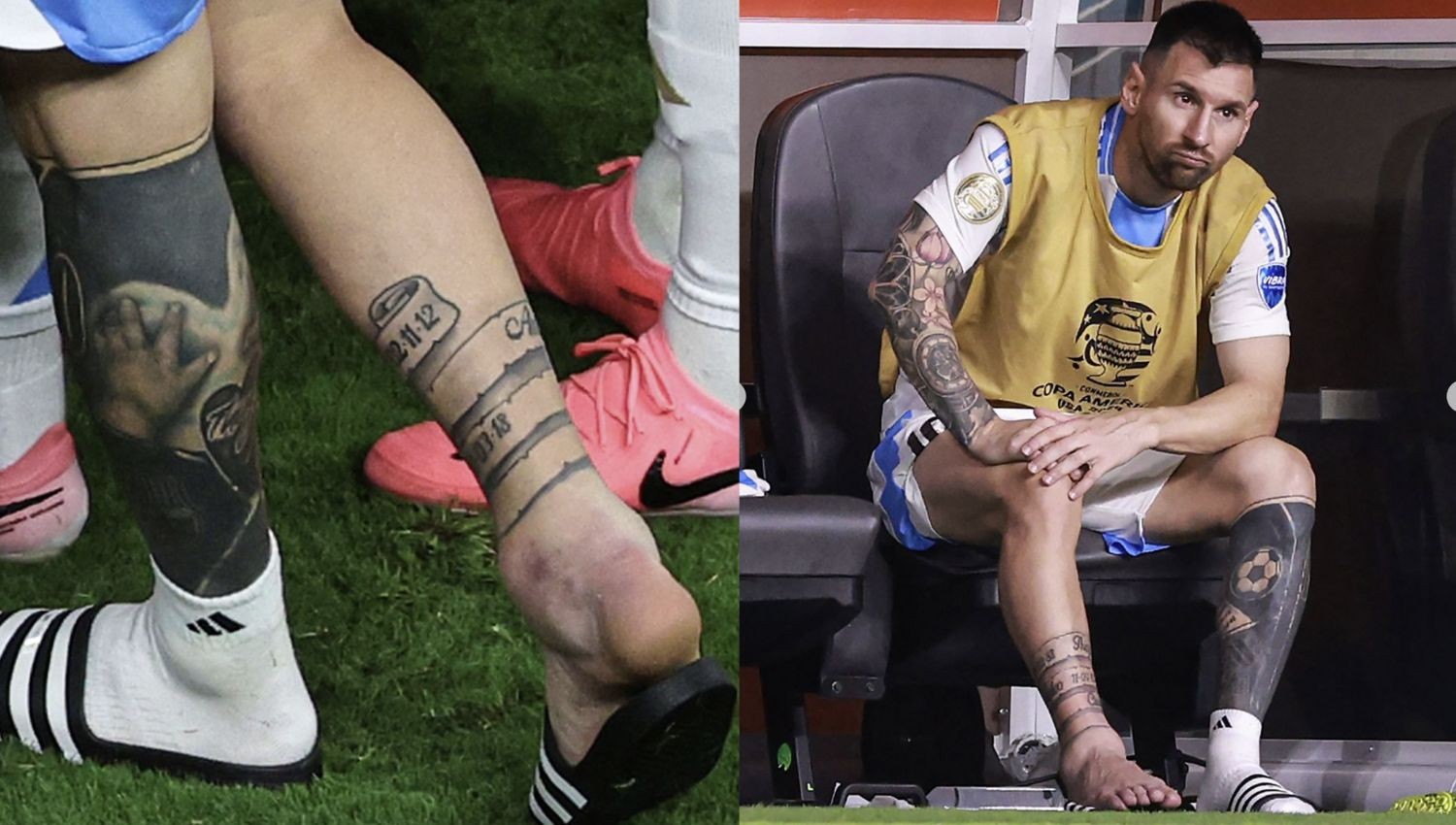 Lionel Messi Cedera Saat Bela Timnas Argentina, Dipastikan Absen Bersama Inter Miami