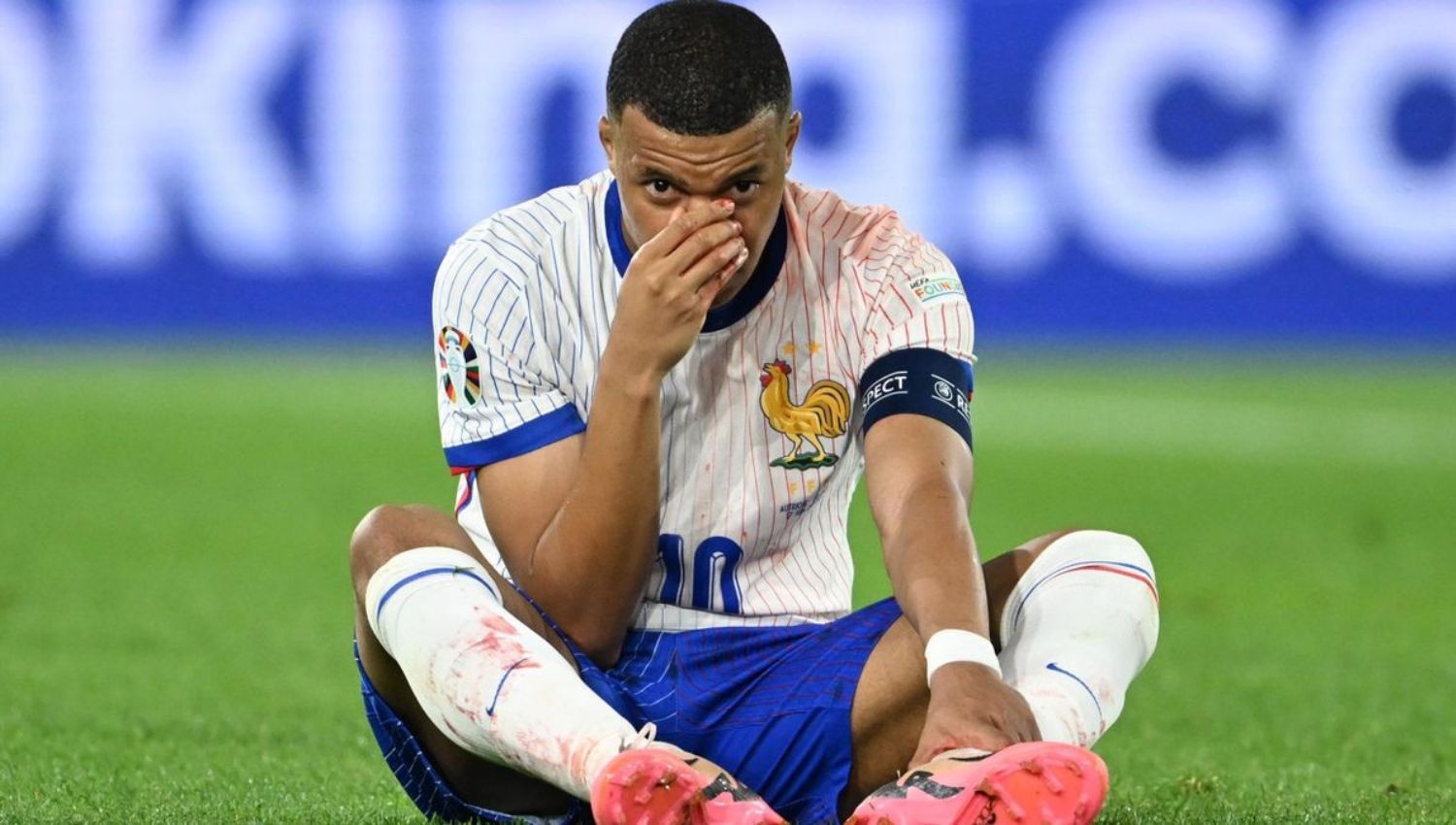 Euro 2024: Hidung Patah saat Lawan Austria, Kylian Mbappe Jalani Operasi